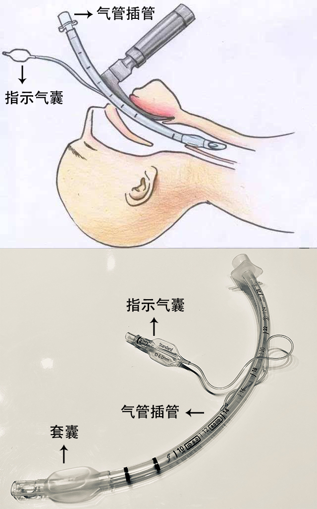 贊?。?！250萬指示氣囊，客戶100%滿意！